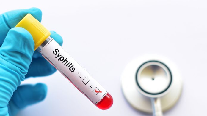 sifilis